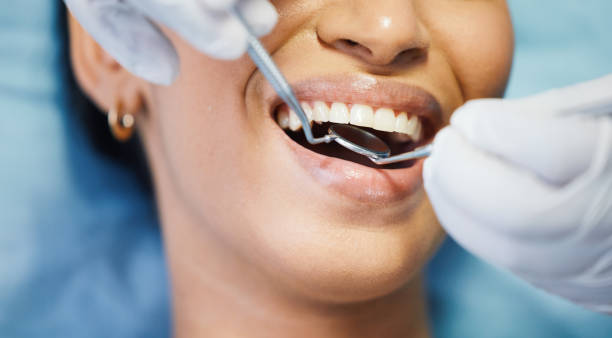 Best Emergency Wisdom Teeth Removal in Choudrant, LA